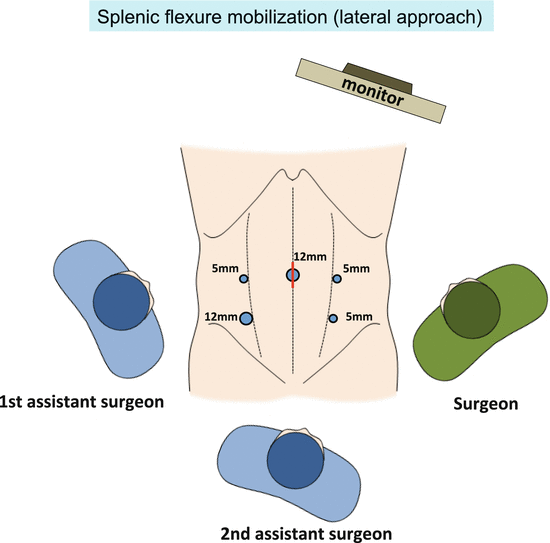 splwnic flexture anatomy