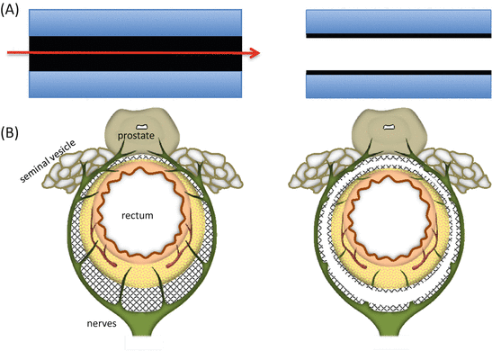 A336115_1_En_6_Fig2_HTML.gif