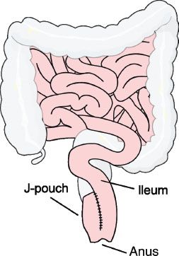 Shell Key Bowel image01458.jpeg | Abdominal Key