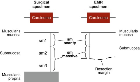 A215143_1_En_3_Fig3_HTML.jpg