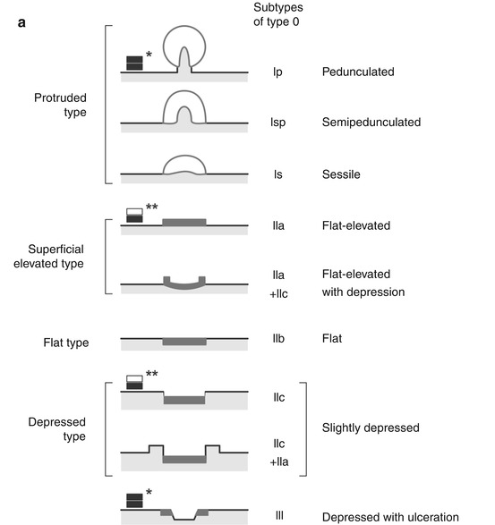 A215143_1_En_4_Fig2a_HTML.jpg