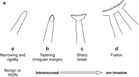 A215143_1_En_8_Fig2e_HTML.gif