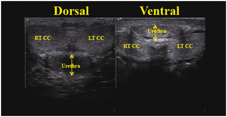 Penile Ultrasound Abdominal Key