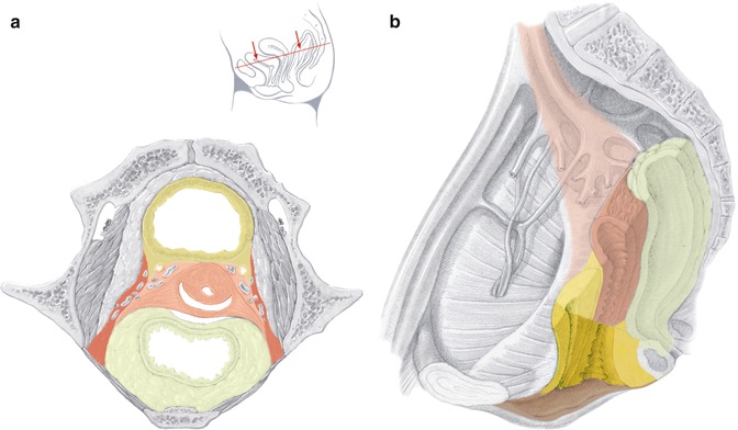 A305428_1_En_37_Fig1_HTML.jpg