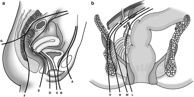 A305428_1_En_52_Fig2_HTML.jpg