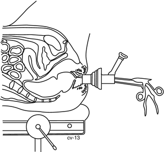 A305516_1_En_11_Fig3_HTML.gif