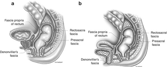 A78842_2_En_1_Fig3_HTML.jpg