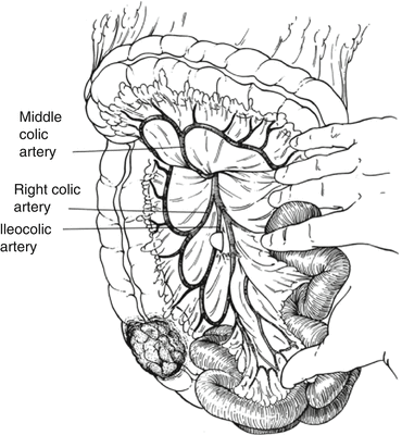 A78842_2_En_41_Fig2_HTML.gif