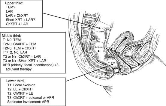 A78842_2_En_44_Fig3_HTML.gif