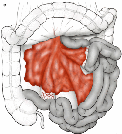 A978-1-4614-9022-7_5_Fig1b_HTML.gif