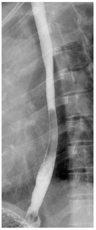 Of The Upper Gastrointestinal Tract | Abdominal Key