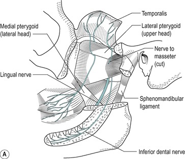 gr12a.jpg | Abdominal Key