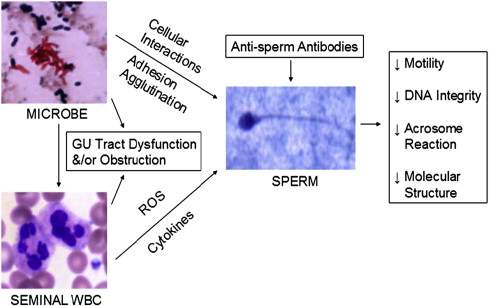 Infectious, Inflammatory, and Immunologic Conditions Resulting in Male