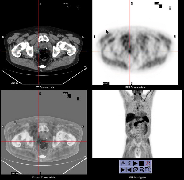 gr4.jpg | Abdominal Key