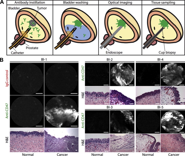 gr4.jpg | Abdominal Key