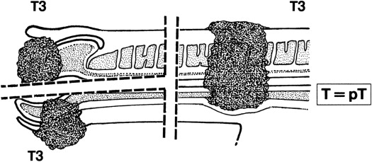 gr4.jpg | Abdominal Key