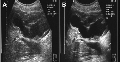 gr4.jpg | Abdominal Key