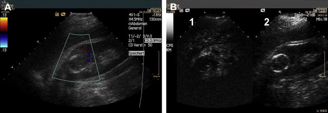 gr4.jpg | Abdominal Key
