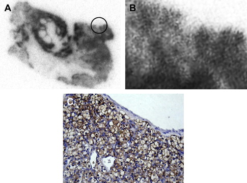 gr4.jpg | Abdominal Key