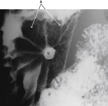 gr4.jpg | Abdominal Key
