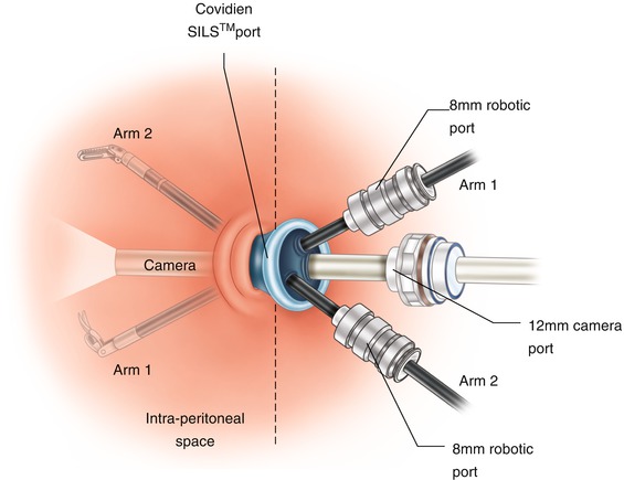 A302089_1_En_10_Fig1_HTML.jpg