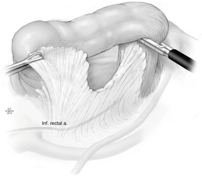 A309502_1_En_8_Fig18_HTML.gif | Abdominal Key