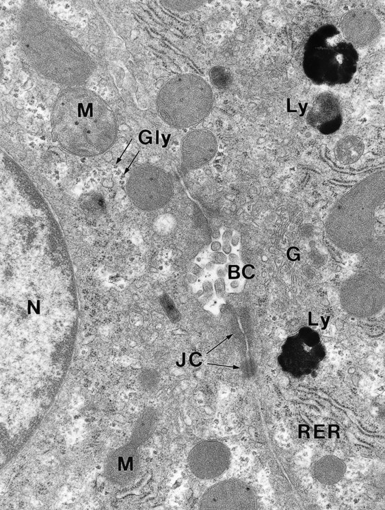 Electron Microscopy And Other Techniques | Abdominal Key