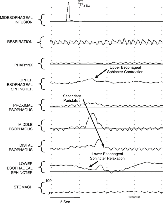 A191925_2_En_3_Fig2_HTML.gif | Abdominal Key