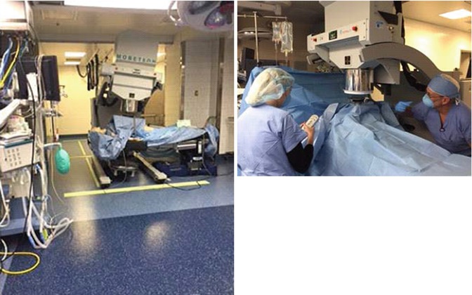 Rectal And Colon Cancer Radiation Therapy Planning Abdominal Key