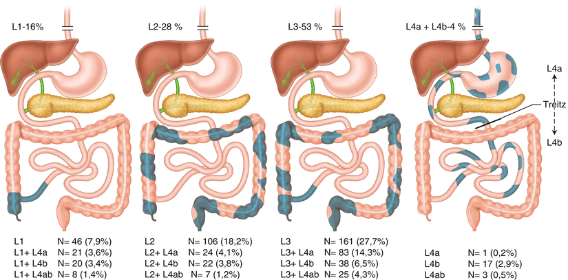 A126025_3_En_41_Fig1_HTML.gif | Abdominal Key