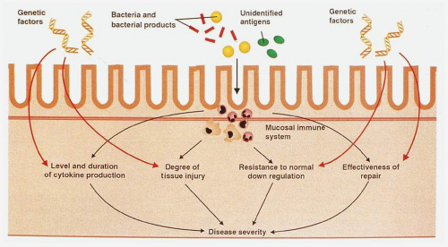 Inflammatory Bowel Disease | Abdominal Key