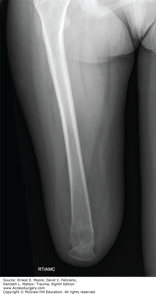 Lower Extremity | Abdominal Key