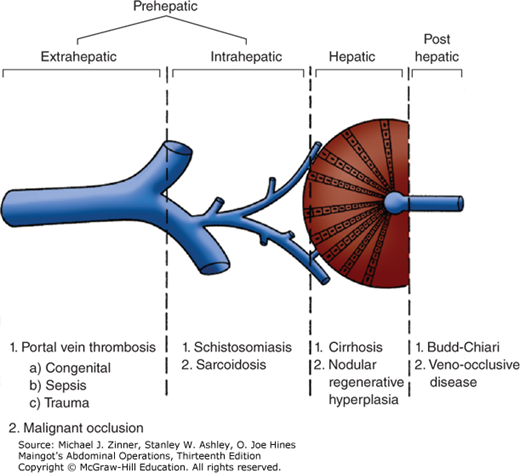 Portal Hypertension Diagram