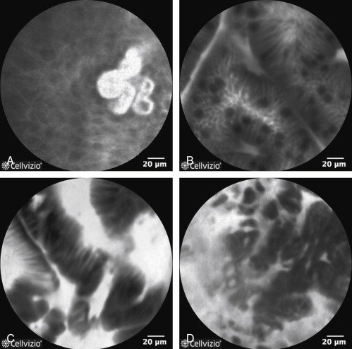 Esophagus | Abdominal Key