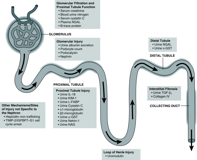 Acute Kidney Injury Diagnostics And Biomarkers | Abdominal Key