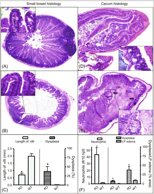 Intestinal Absorption Of Water-Soluble Vitamins: Cellular And Molecular ...