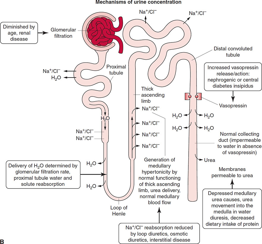 Disorders Of Water Homeostasis | Abdominal Key