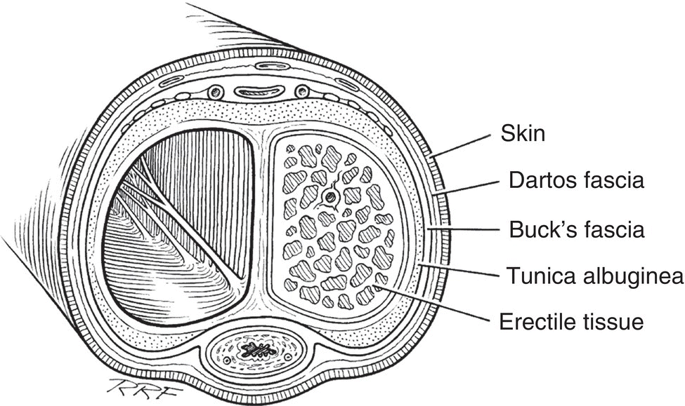 Incision: Endoscopic Management Of Urethral Stenoses | Abdominal Key