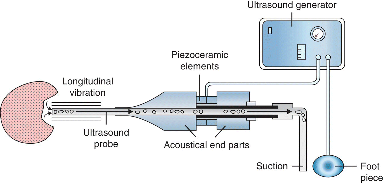 c26f003.gif | Abdominal Key