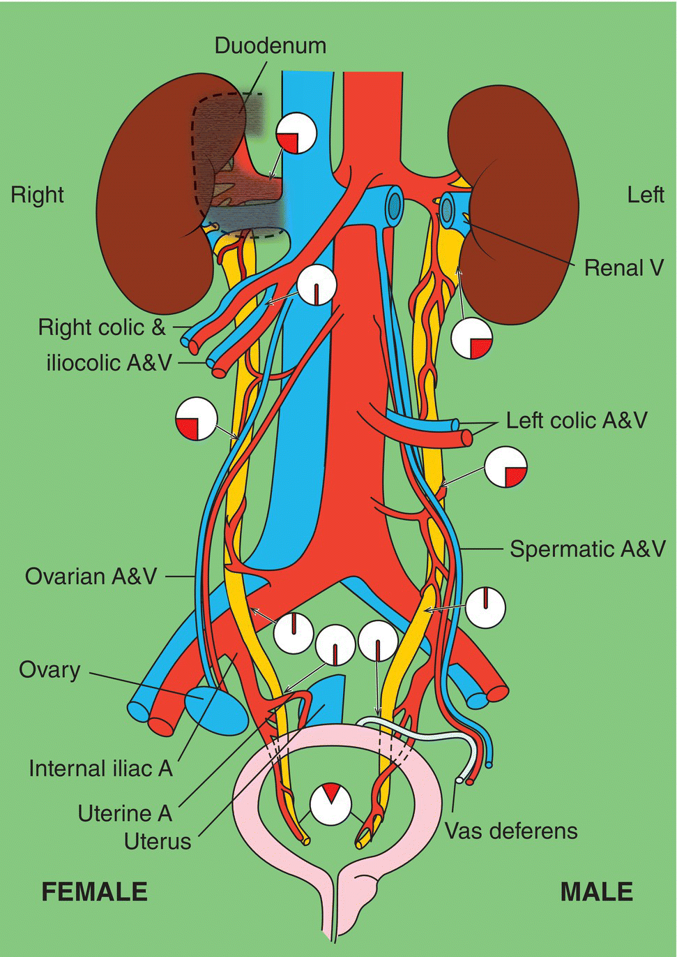 Endoscopic Management Of Distal Ureteral Strictures | Abdominal Key