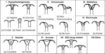 Chapter 2 – Anatomy And Physiology Of The Uterus | Abdominal Key