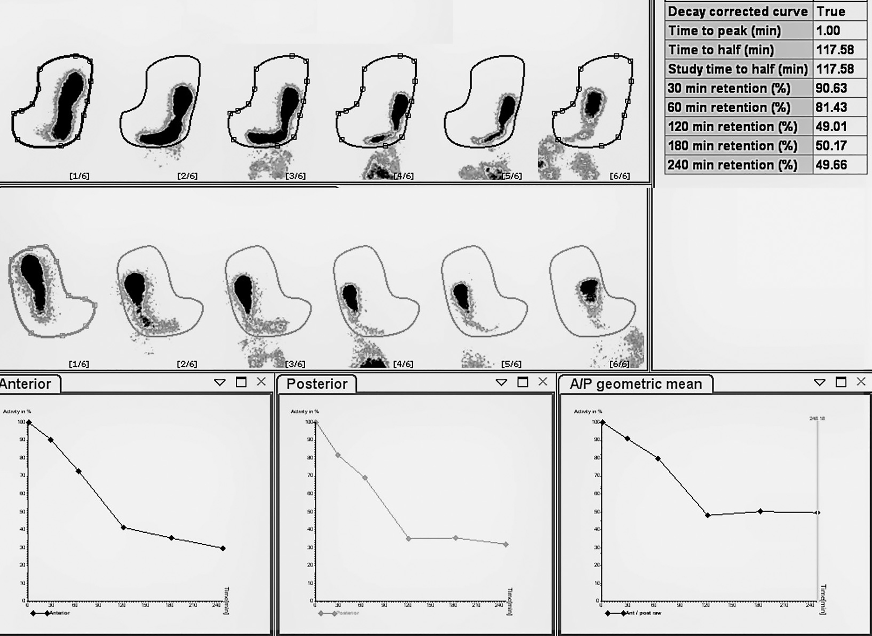 Gastric Emptying Scintigraphy | Abdominal Key