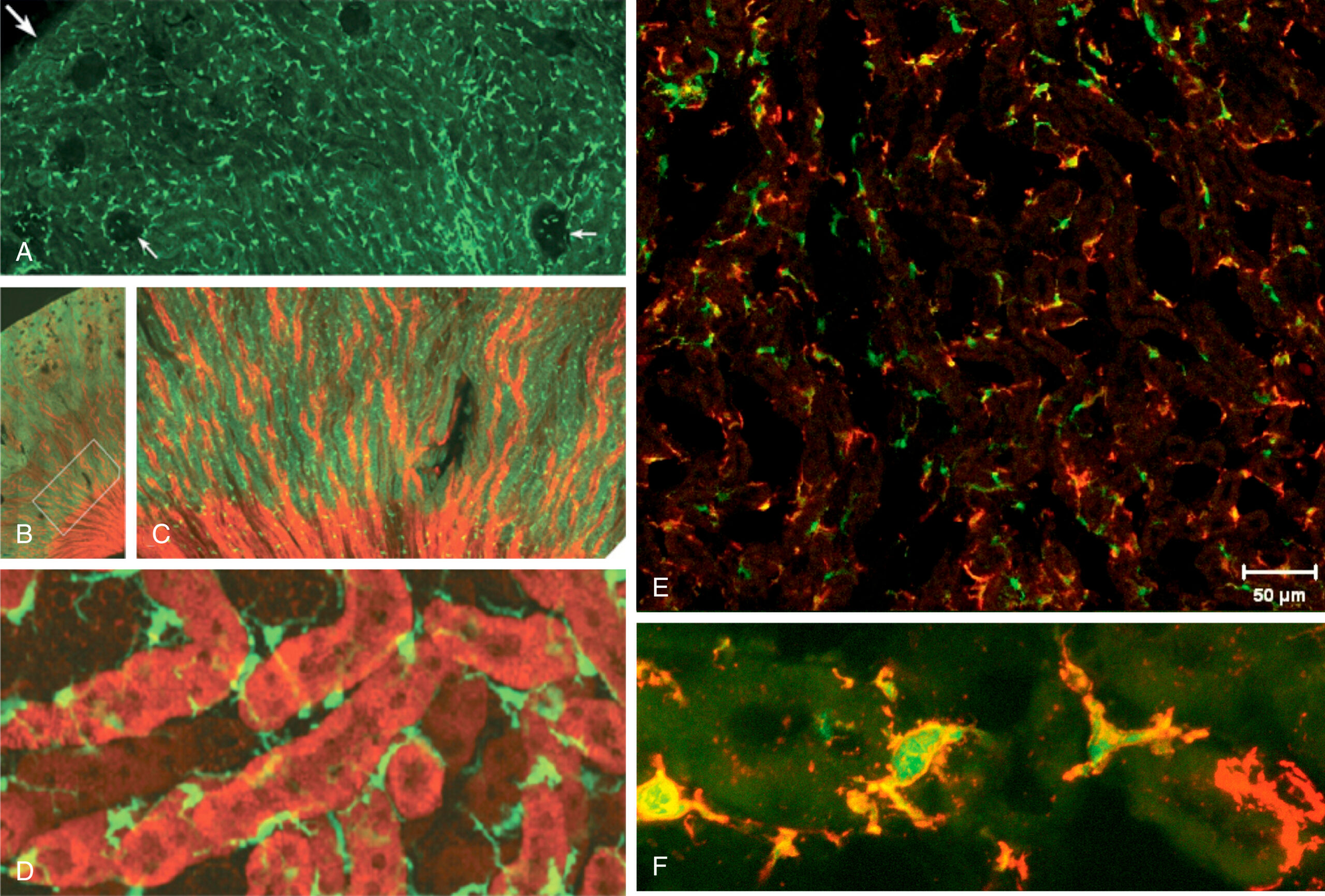 Six micrographs, labeled A to F, show C X 3 C R 1-positive cells in kidney tissue, including cortex, medulla, and glomeruli, highlighting mononuclear phagocyte distribution and heterogeneity. The first micrograph, labeled A, shows a section of the superficial cortex with densely distributed C X 3 C R 1-positive cells filling the interstitial space. Large arrows indicate extensions of these cells to the cortical edge, and small arrows point to C X 3 C R 1-positive cells surrounding Bowman’s capsule. C X 3 C R 1-positive cells are also visible within glomeruli. The second micrograph, labeled B, shows a broad view from capsule to papilla, with red-fluorescing tubules marking distal tubules and collecting ducts. The third micrograph, labeled C, is a magnified view of the boxed region from B, showing C X 3 C R 1-positive cells in the medullary interstitium aligned in parallel with red fluorescing structures. The fourth micrograph, labeled D, presents a three-dimensional rendering of stellate-shaped C X 3 C R 1-positive cells within the medullary interstitial space, bounded by red-fluorescing tubular segments. The fifth micrograph, labeled E, shows kidney medullary sections from C X 3 C R 1-positive mice, with distinct populations of mononuclear phagocytes and alternating cells with one or both markers. A 50 micrometer scale bar is visible in E. The sixth micrograph, labeled F, is a higher magnification Z-stack projection of alternating cells of bands.